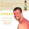 Wild Harvested Cactus Gel - Instant Itch, Rash and Burn Relief - Wild Cactus Skin Repair Gel